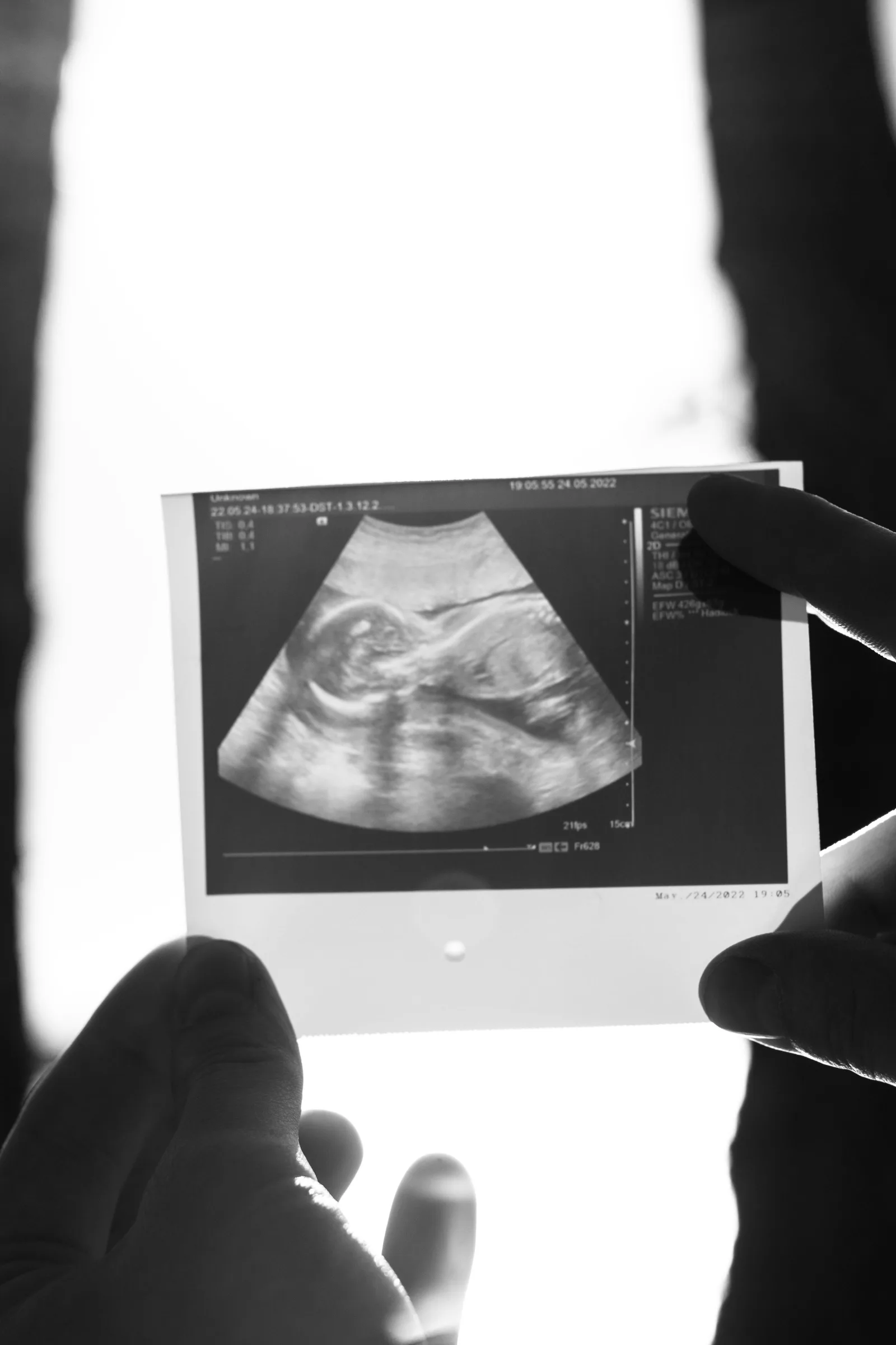 Pregnancy Worries: There's No Such Thing as a Silly Call